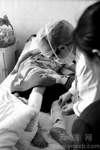 何彦花除了耳膜受伤之外,双腿也在爆炸中受伤。